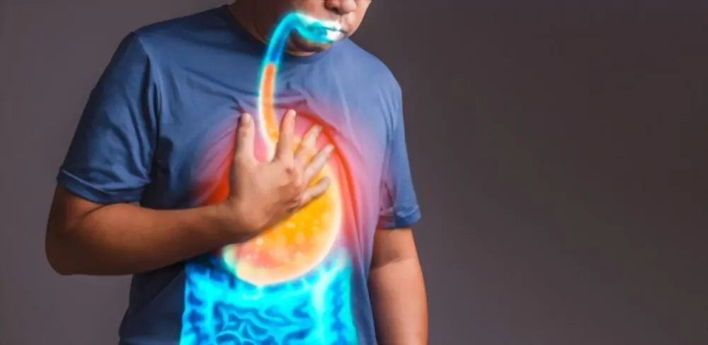 acid reflux