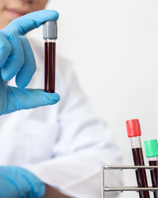 is omega 3 fish oil is a blood thinner 